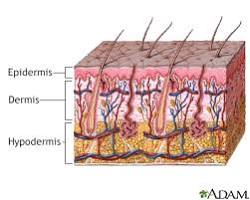 Image of Cellulitis skin