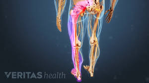 Image result for Leg Pain