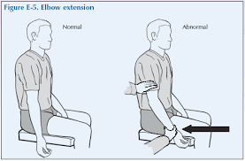 Maybe you would like to learn more about one of these? Global Alliance For Musculoskeletal Health The Elbow