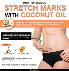 In essence, stretch marks appear because of different reasons such as weight gain, pregnancy, puberty and so on. How To Use Coconut Oil To Remove Your Stretch Marks