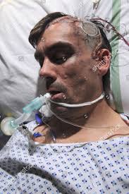 Debbie Dingle Gets Upset About Cain Editorial Stock Photo