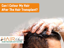 After you finally dye your strands to the perfect, pretty hair color, it's hard not to get upset over the thought that it will eventually fade away over time.with the proper care, however, you can keep your color looking vibrant for longer. Can I Colour My Hair After Hair Transplantation Cyber Hairsure