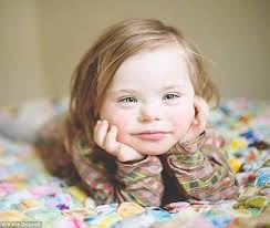 Baby Faces Dear World Disabled Children