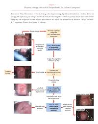 Image result for Cervical Cancer Screening