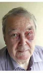 Bernard Browne's Instagram, Twitter & Facebook