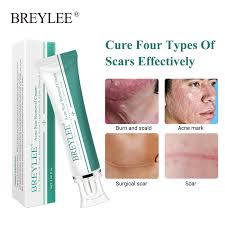 10 best korean skincare products for acne scars reviewed. Breylee Acne Scar Removal Cream 30g Face Cream Skin Repair Skin Care Scar Acne Treatment Remove Stretch Marks Whitening Cream Aliexpress