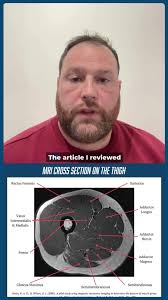 Go behind the research with Alex as he breaks down his latest article in  this month’s Science of Rowing! 🧠💥 He explains how MRI was used to  explore the role of the Adductor Magnus in rowers' muscle ...