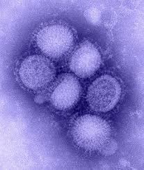 So, what is this infection and how does it spread? Swine Influenza Wikipedia