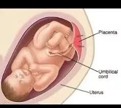 When is umbilical cord blood used for a transplant? What Is The Difference Between Placenta And Umbilical Cord Quora