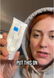 Cómo superé la dermatitis perioral y la retirada de esteroides