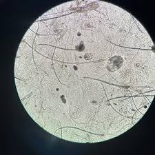 Image result for Demodex brevis