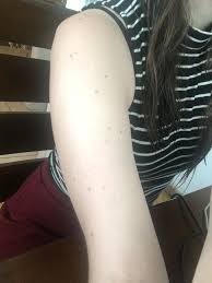 Different tattoo designs and ideas might be appealing to different people based on what makes them unique. Tattoos Around Incorporating Many Beauty Marks Initiation Last Sparrow Tattoo