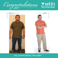 Pin On Before After