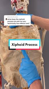 Xiphoidalgia Syndrome - Cause, Symptoms, Treatment, Exercise