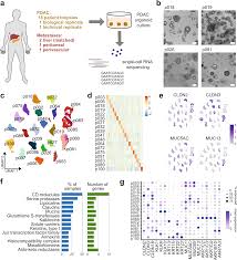 Home office und 3d printing bis mobile lifestyle und . Single Cell Analysis Of Patient Derived Pdac Organoids Reveals Cell State Heterogeneity And A Conserved Developmental Hierarchy Nature Communications