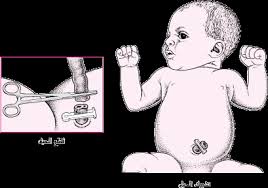 We did not find results for: ØºØ±ÙØ© Ø§Ù„ÙˆÙ„Ø§Ø¯Ø© Ø§Ù„ÙˆÙ„Ø§Ø¯Ø© Ø§Ù„Ø·Ø¨ÙŠØ¹ÙŠØ© ÙÙŠ Ø§Ù„Ù…Ù†Ø²Ù„ Ø¨Ù…Ø³Ø§Ø¹Ø¯Ø© Ø§Ù„Ø²ÙˆØ¬ If