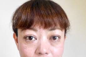 Последние твиты от ケイン・ヤリスギ「♂」 (@kein_yarisugi). ãƒã‚»ãƒ‰ã‚¦ç—… Graves Disease Japaneseclass Jp