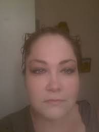 Motorcycle accident victim shares story