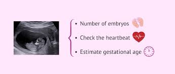 Image result for First Trimester Ultrasound
