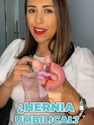 🤔 ¿Te has preguntado qué es una hernia umbilical? Si notas un pequeño  bulto cerca de tu ombligo, podría ser más que una simple #Hernias  #CuidaTuSalud. ¡Es hora de descubrir lo que tu cuerpo está ...
