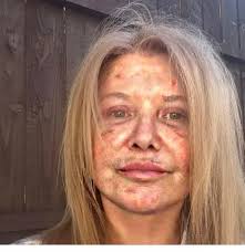 Andre Reid photo with filter she has used removed . Don't fall for her fake  filtered photos she is after sales for her surgeon she is a rep