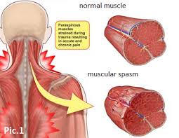 защемило нерв в пояснице отдает в ногу что делать Vliyanie Zabolevanij Pozvonochnika Na Nervnuyu Sistemu Metody Lecheniya