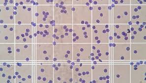 Image result for CSF PCR