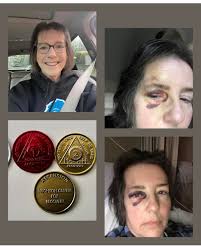 Recovery from Addiction: 90-Day Sobriety Milestone