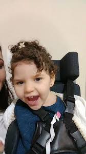 Síndrome de Aicardi