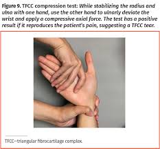 Image result for Scaphoid Shift Test