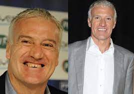 Biografía de didier deschamps incluyendo fotos de infancia/colegio y grabaciones de la primera vez en apprenez à connaître le footballeur de 53 ans, didier deschamps, avant qu'il soit célèbre (p.ex. Didier Deschamps Dit Pourquoi Il S Est Fait Refaire Les Dents Elle