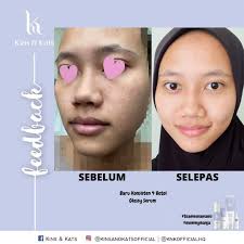 Manja TOP LEADER KINS &KATS