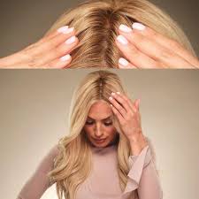 Hair swept off the floor is guidelines hair should be at least 8 inches in length. Dealing With Hair Loss After A Cancer Treatment Coronet Hair