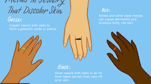 Why Do Rings Turn Your Finger Green?