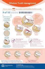 Pin On Wisdom Teeth Management