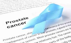 Even a big mass on your prostate that looks like cancer might be in this matter, every case should be evaluated individually, and only a trained specialist is suitable for the job. The 10 Most Fatal Cancers For Men And How They Re Detected