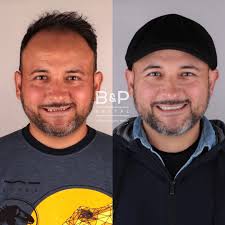 COLABORADORES B&P🦷🪥 Dra Sony Sanchez⭐️