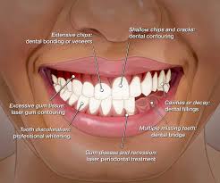 We did not find results for: How Much Is To Remove A Tooth In South Africa