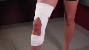 Le diagnostic des entorses du genou et des lésions méniscales est principalement clinique. Strapping Entorse De Genou Youtube