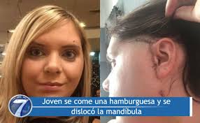 Joven se come una hamburguesa y se dislocó la mandíbula ➡  https://bit.ly/2UjdUUe