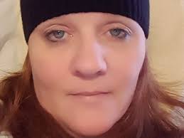 Fundraiser by Tammy Breeden : Please Help Tammy through Surgery