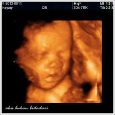 Aku Bukan Bidadari Sah Kempem Baby Boy