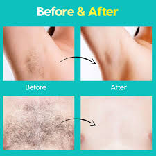 The american academy of dermatology recommends a hair length of ¼ inch to ¾ inch. Generic Kassia Body Wax Strips Wax Strips For Arms Legs Underarm Hair Eyebrow Bikini Brazilian Waxing Kit Contains 68 Strips And
