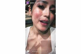 Wajah Jessica Iskandar Memerah Seperti Terbakar Ada Apa Halaman All Kompas Com