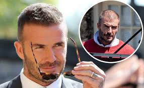 Il trapianto dei capelli è diventato la moda del momento e molti . Trapianto Capelli Vip Masullo Medical Group