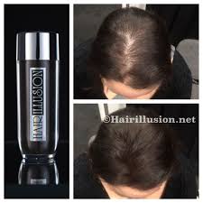 Hair Illusion Womens Hair Loss Hair Fibers Not Toppik Caboki Xfusion Dark Brown Hairillusion Hair Illusion Hair Fibers Hair Loss Women