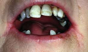You have to see your doctor or a dermatologist to have a proper diagnosis. 2 Differential Diagnosis By Signs And Symptoms Pocket Dentistry