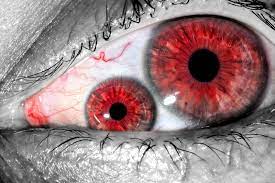 5 Bizarre Eye Conditions - Swagel Wootton Eye Institute
