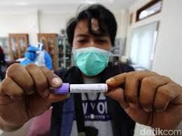 Mengenal Apa Itu Rapid Test Biaya Dan Lokasi Tes Covid 19
