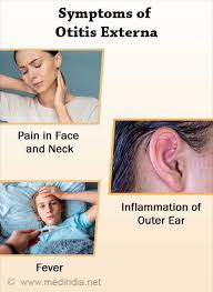 Image result for Acute Otitis Externa